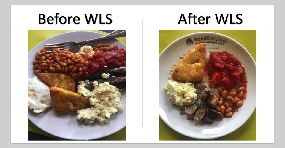 Portions Before & After WLS